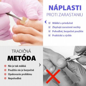 Náplasti proti zarastaniu nechtov 100 ks